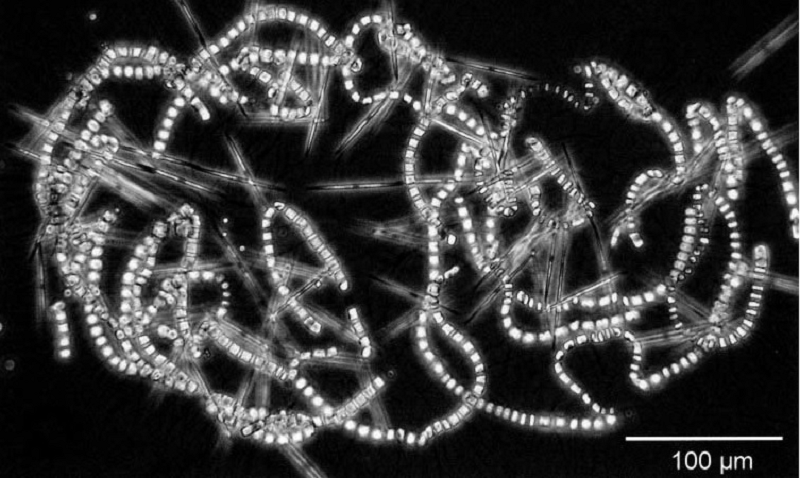 Диатомовые Pseudonitzshia fraudulenta (длинные и тонкие) спрятались в длинные цепочки своих сородичей по отделу Chaetoceros socialis