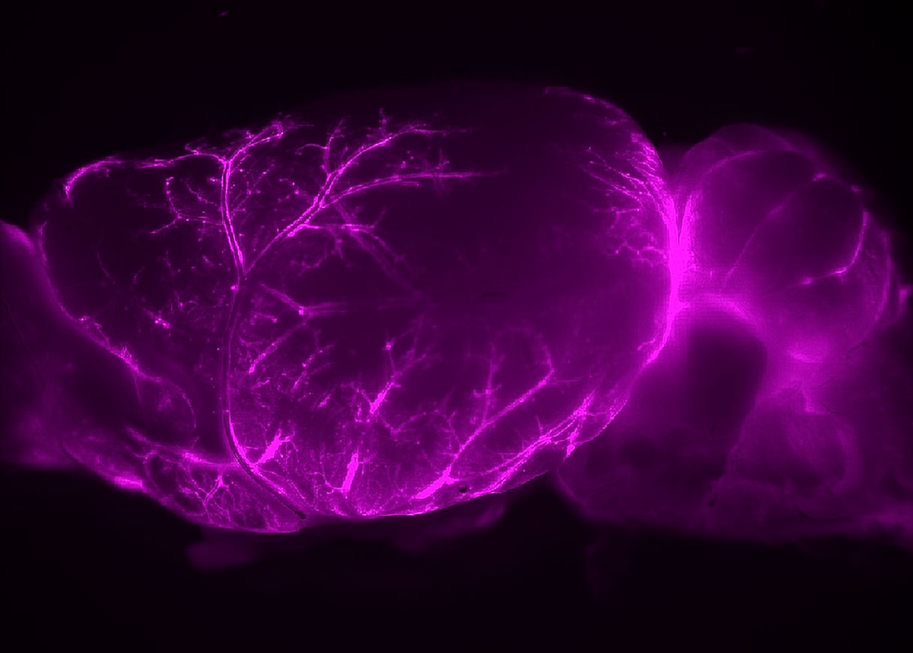 Стимулирование глимфатических путей, обнаруженных в мозге мыши, является возможной стратегией лечения болезни Альцгеймера и других заболеваний