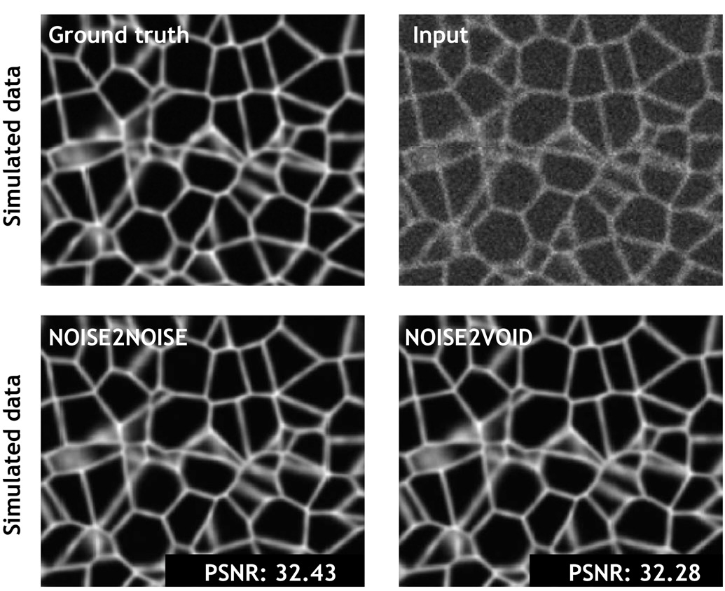 Снижение шума на микрофотографиях клеток