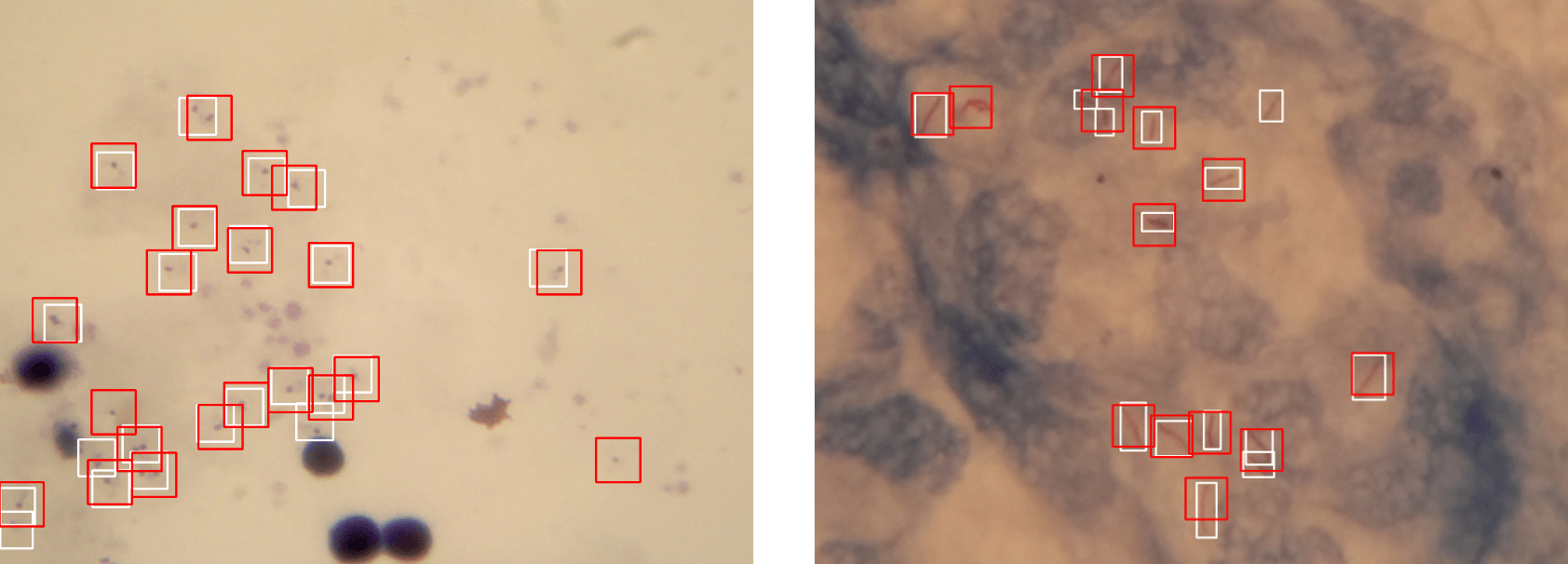 Сопоставление экспертных и автоматизированных обнаружений патогенов