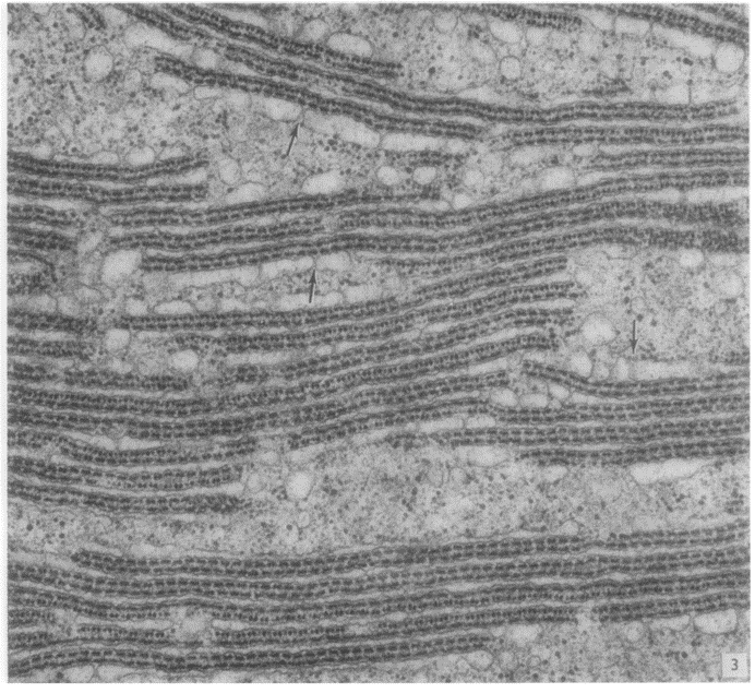 Этап процесса формирования рибосомного тельца в ооците ящерицы в ноябре