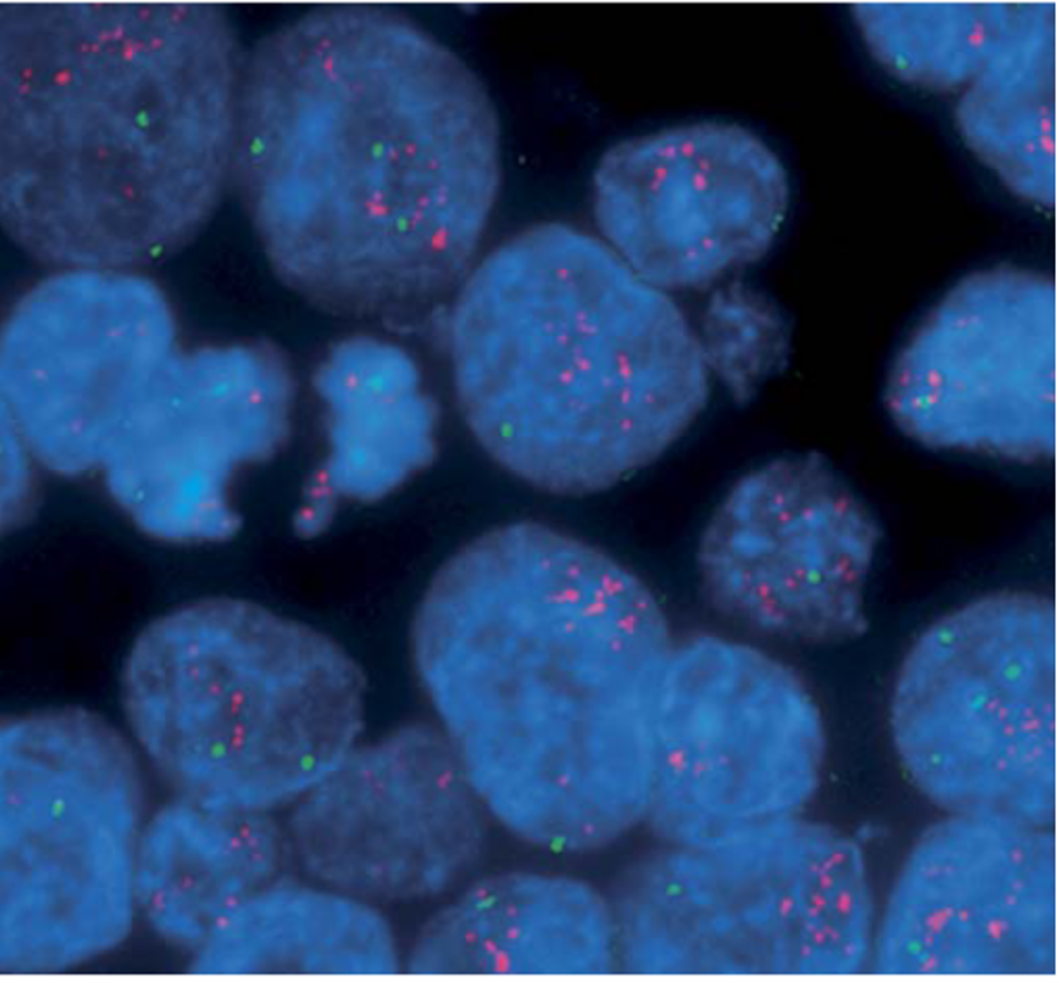 Пример иммуногистохимической окраски