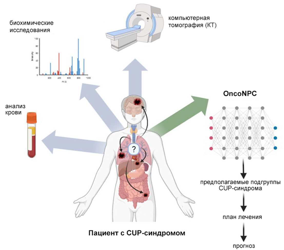 Диагностический алгоритм при CUP-синдроме
