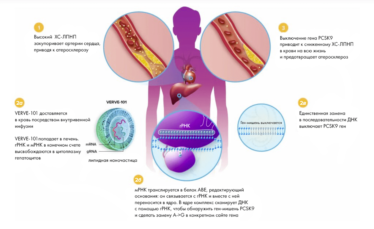 VERVE-101 отключает ген PCSK9, участвующий в метаболизме холестерина