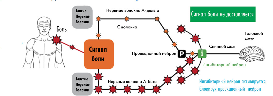 Воротная теория боли