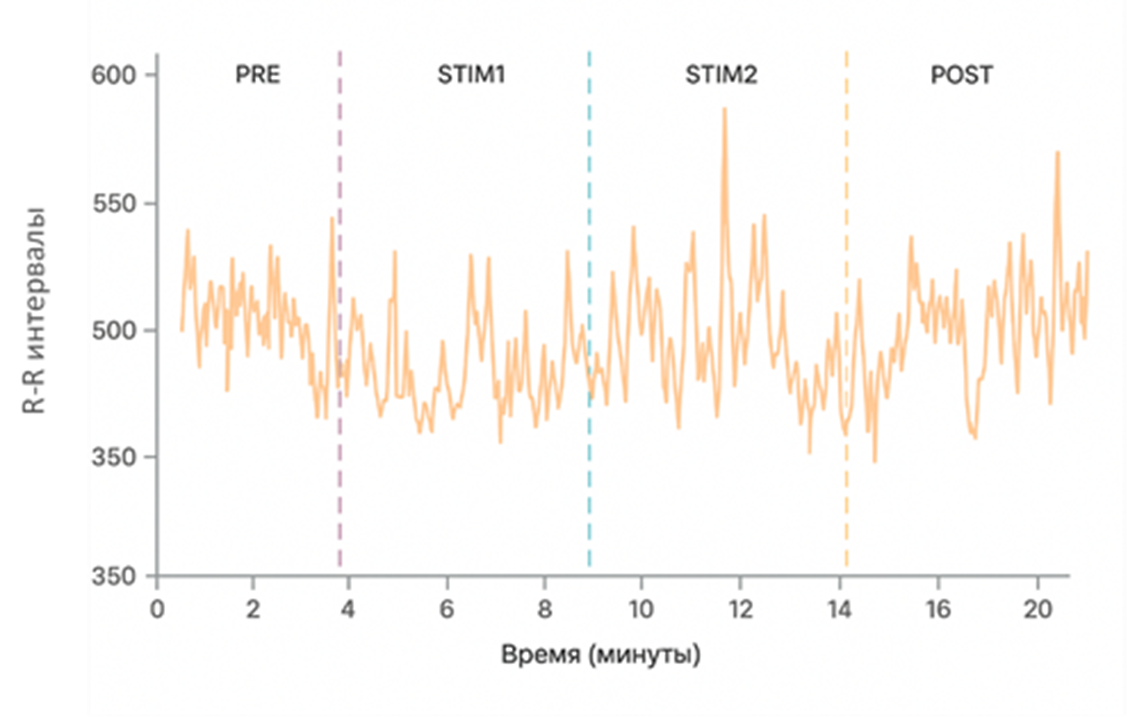 График изменения характера работы вегетативной нервной системы через анализ длины R–R в работе сердца на разных этапах эксперимента