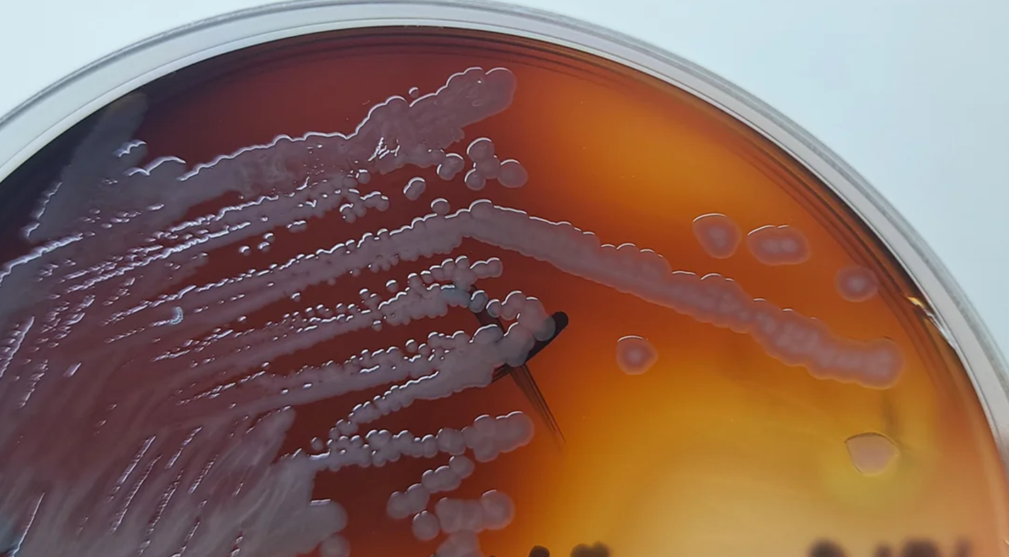 Культура Pseudomonas aeruginosa, выделяющая пиомеланин