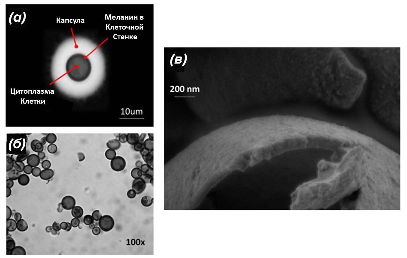 Меланизированный Cryptococcus neoformans и «меланиновые призраки»