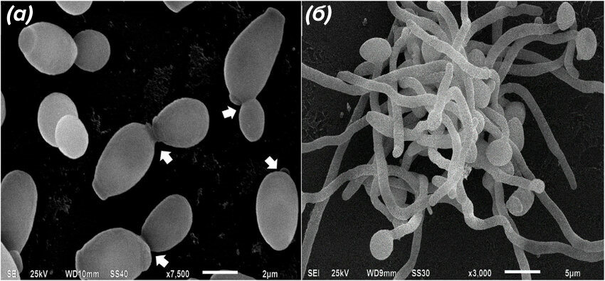 Клетки Candida albicans