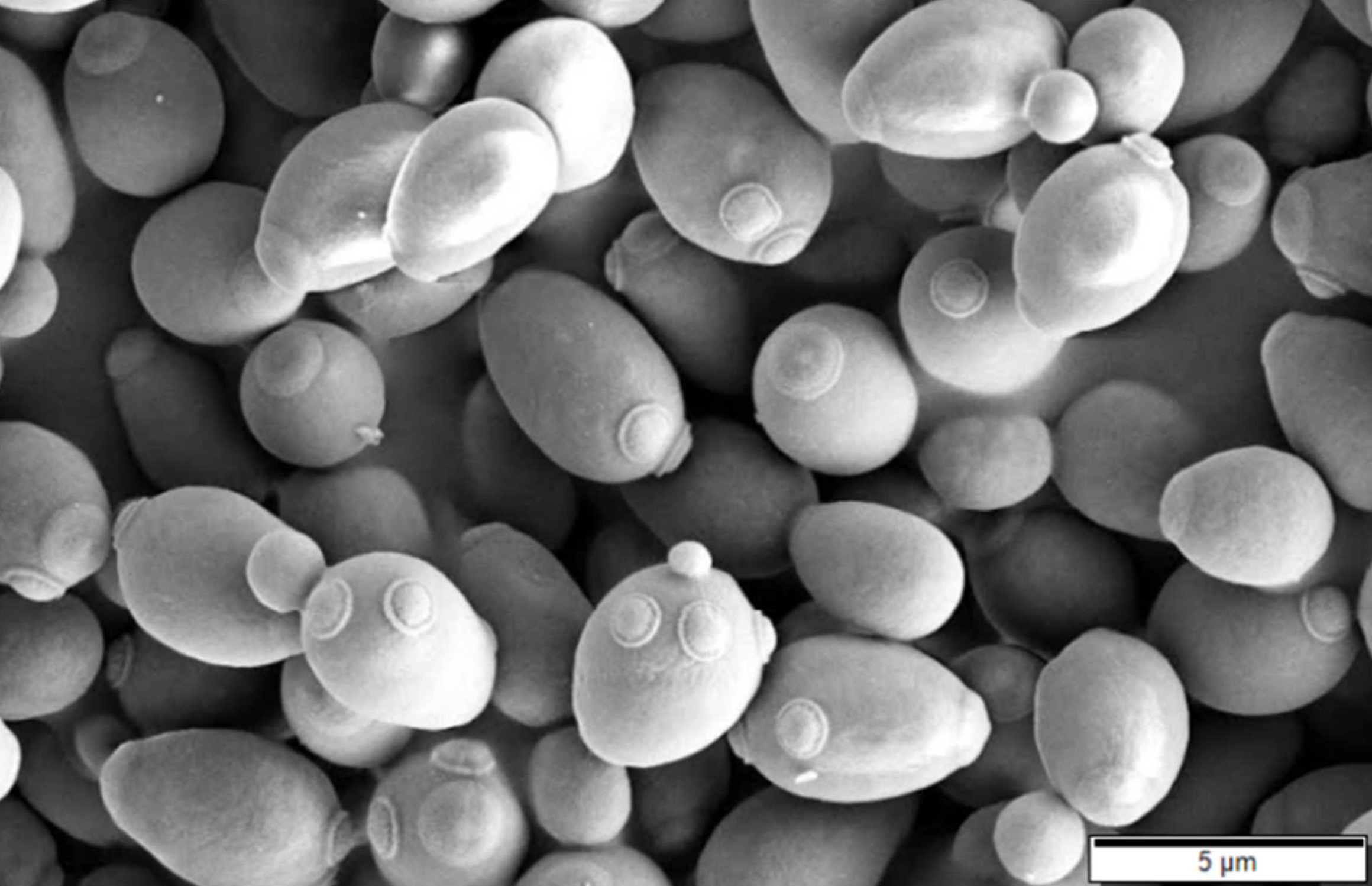 Клетки дрожжей Saccharomyces cerevisiae под микроскопом
