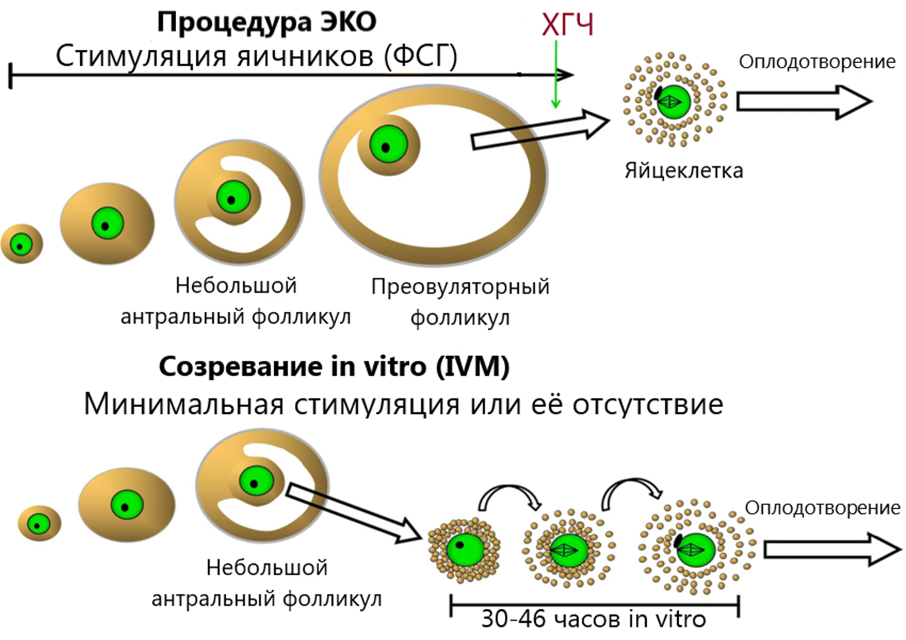 Сравнение традиционных протоколов ЭКО и IVM