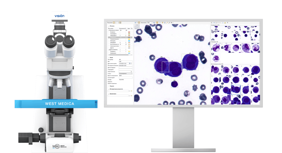 Схематичное изображение работы ИИ-систем для анализа мазков крови