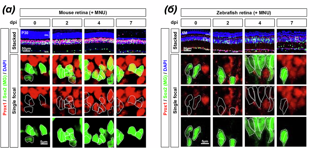 Строение сетчаткии