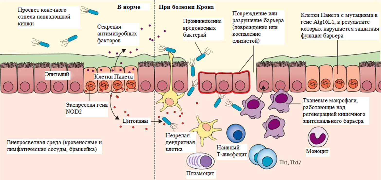 Кишечный эпителиальный барьер в норме и при болезни Крона