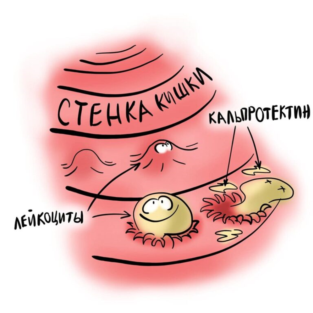 Кальпротектин — наследие лейкоцитов