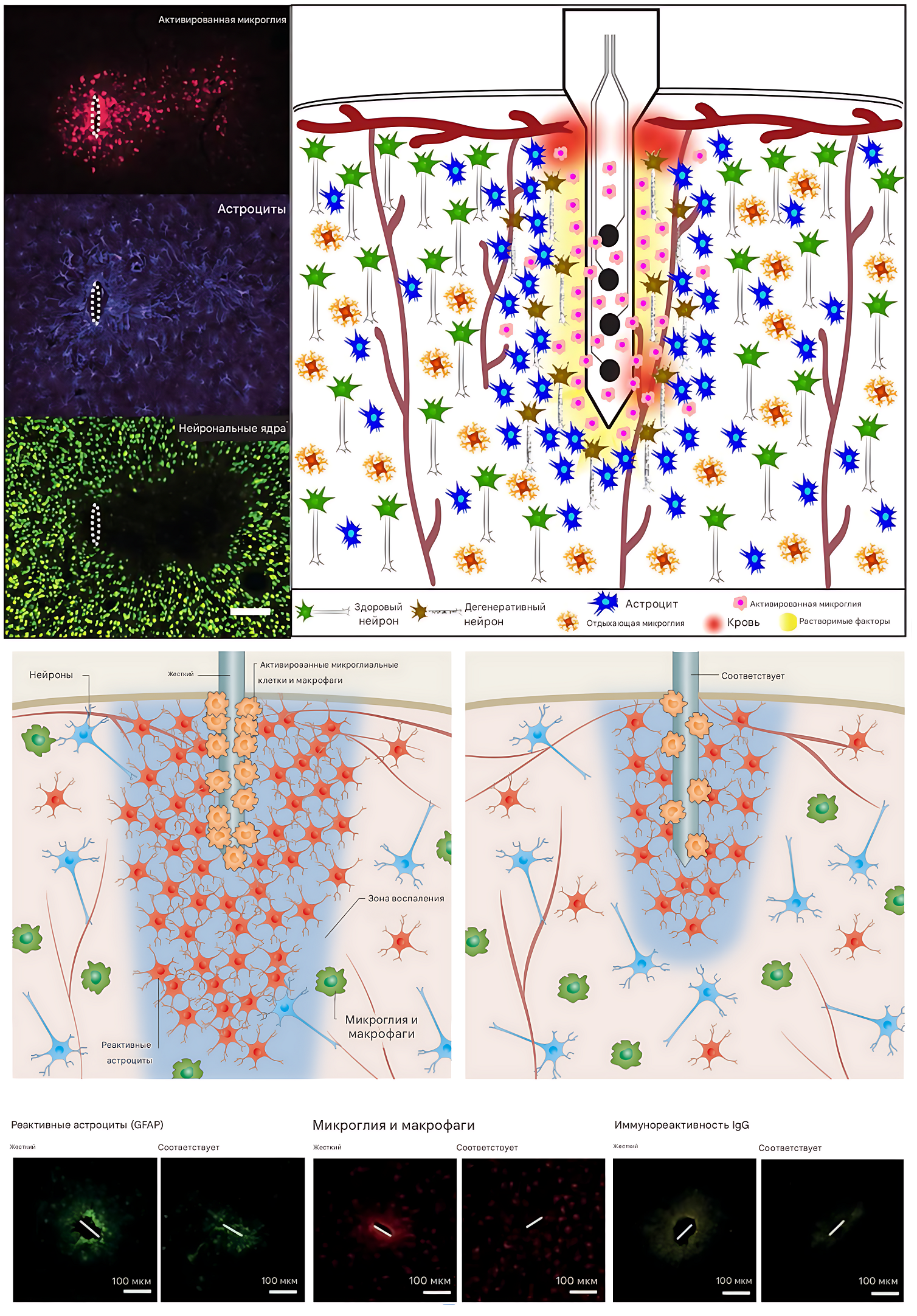 Имплантация электрода приводит к локальным провоспалительным клеточным и биохимическим реакциям