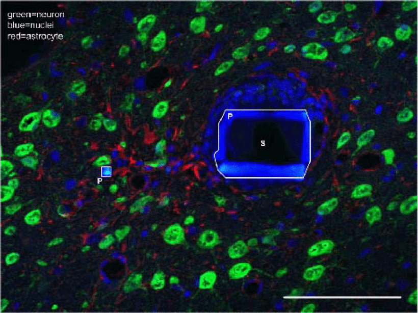 Поперечное флуоресцентное конфокальное изображение