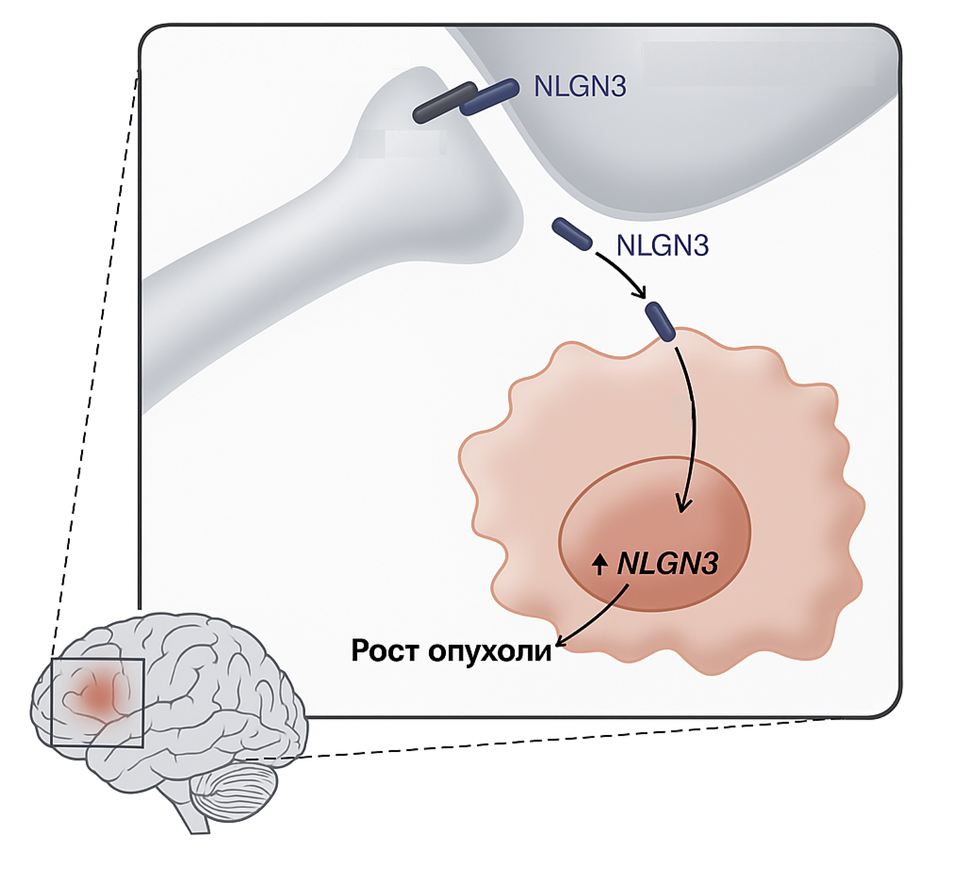 Рост глиомы зависит от активности окружающих нейронов