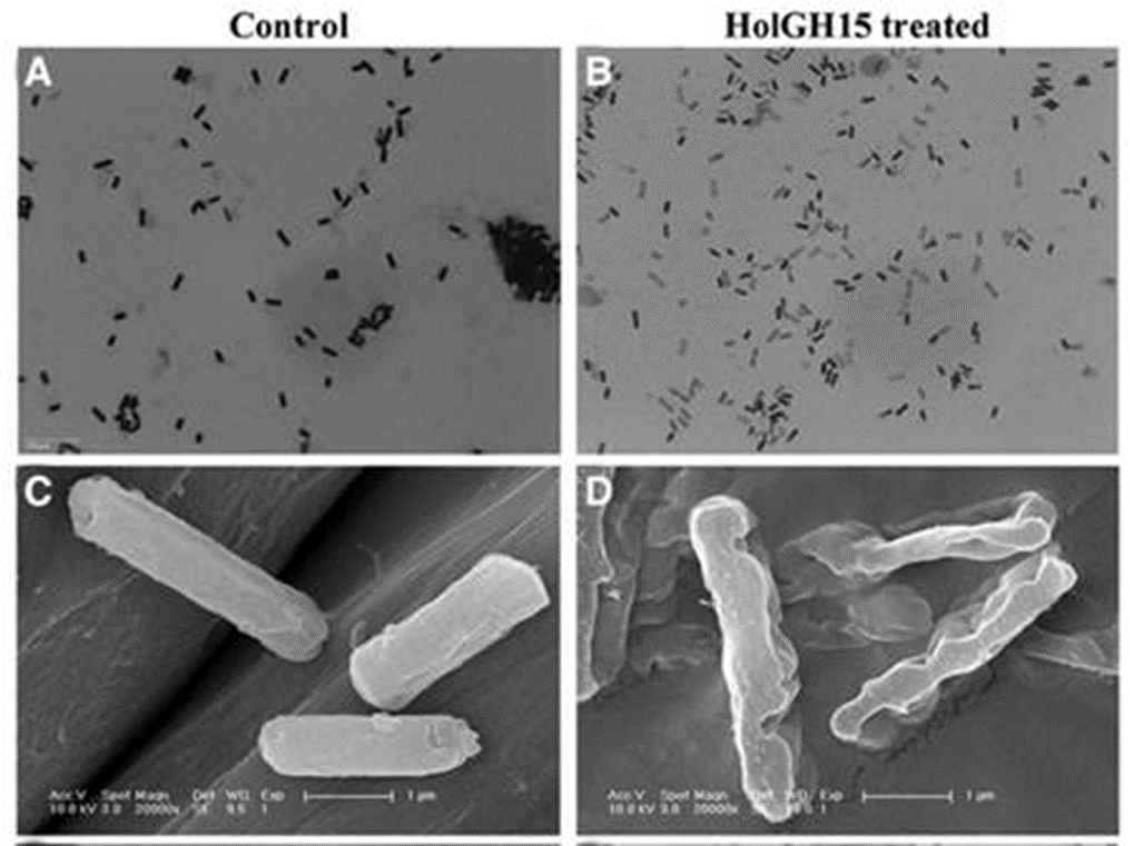 Изменение морфологии клеток Listeria monocytogenes после обработки холинами