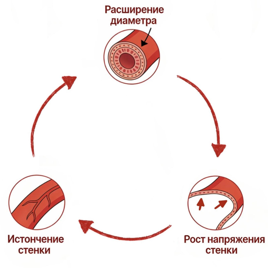 Порочный круг аневризмы