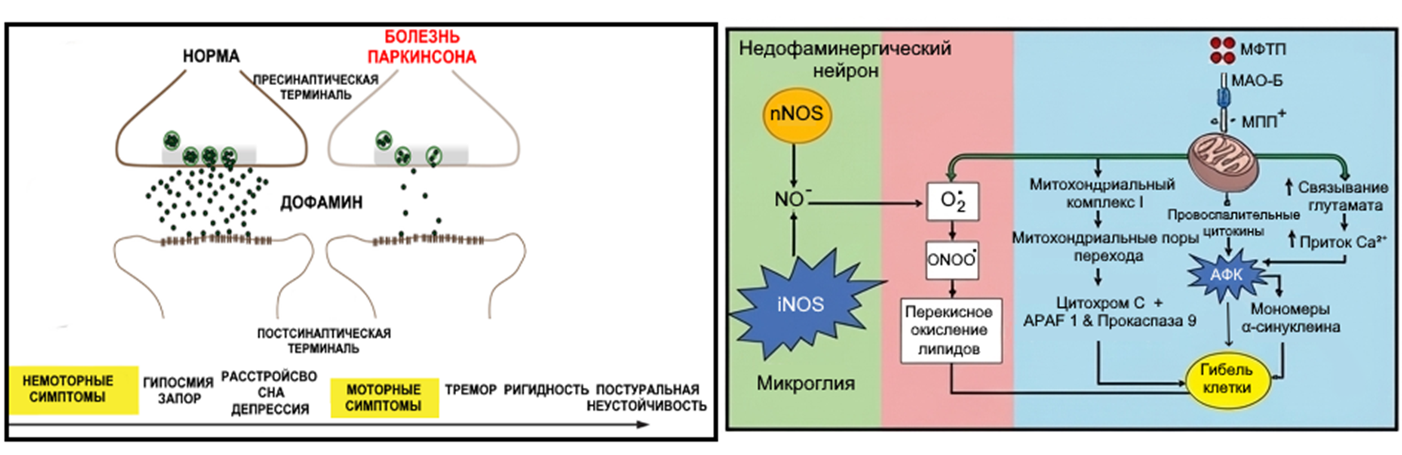 Снижение количества дофамина коррелирует с развитием немоторных и моторных нарушений
