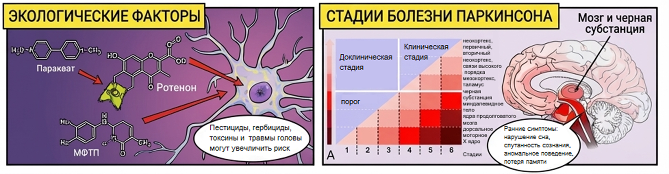 Экологические факторы риска развития и ее стадии болезни Паркинсона (по Брааку)