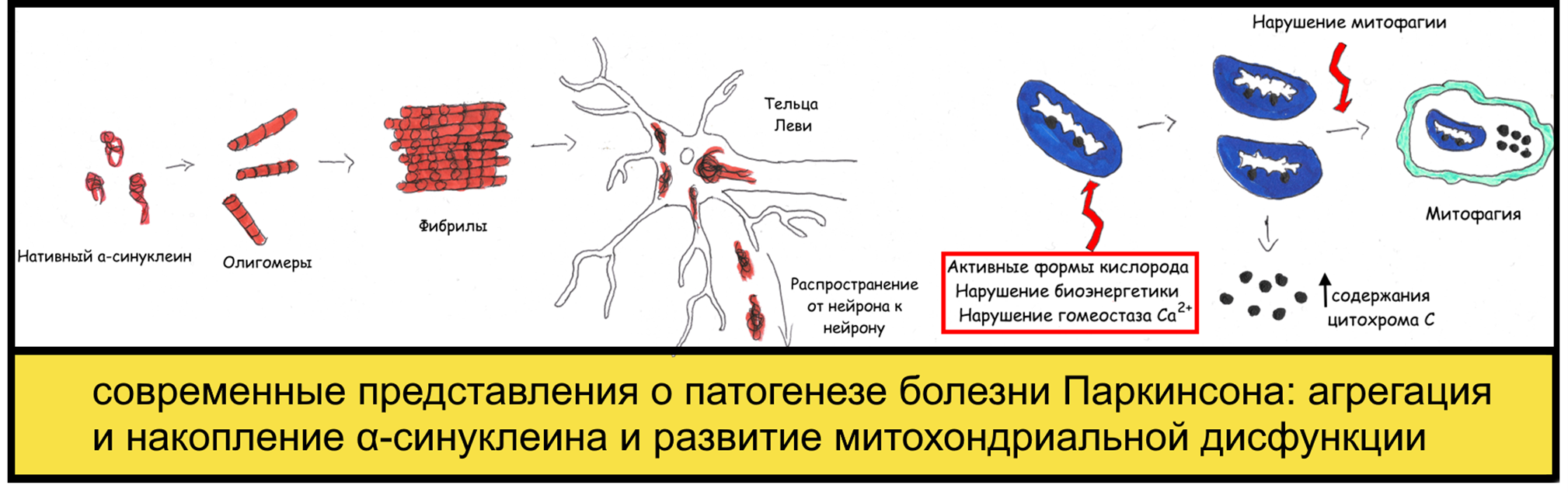 Современные представления о патогенезе болезни Паркинсона