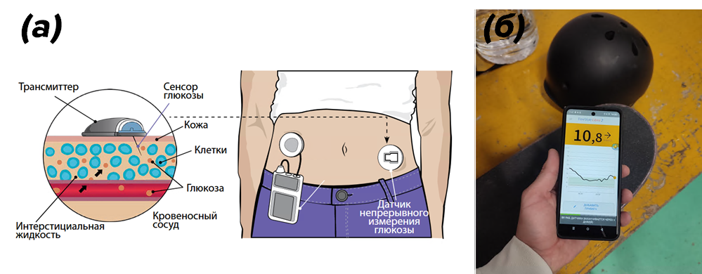Система НМГ состоит из передатчика/трансмиттера, датчика / сенсора (а) и приемника или дисплея (б), в данном случае показатели отображаются на экране смартфона