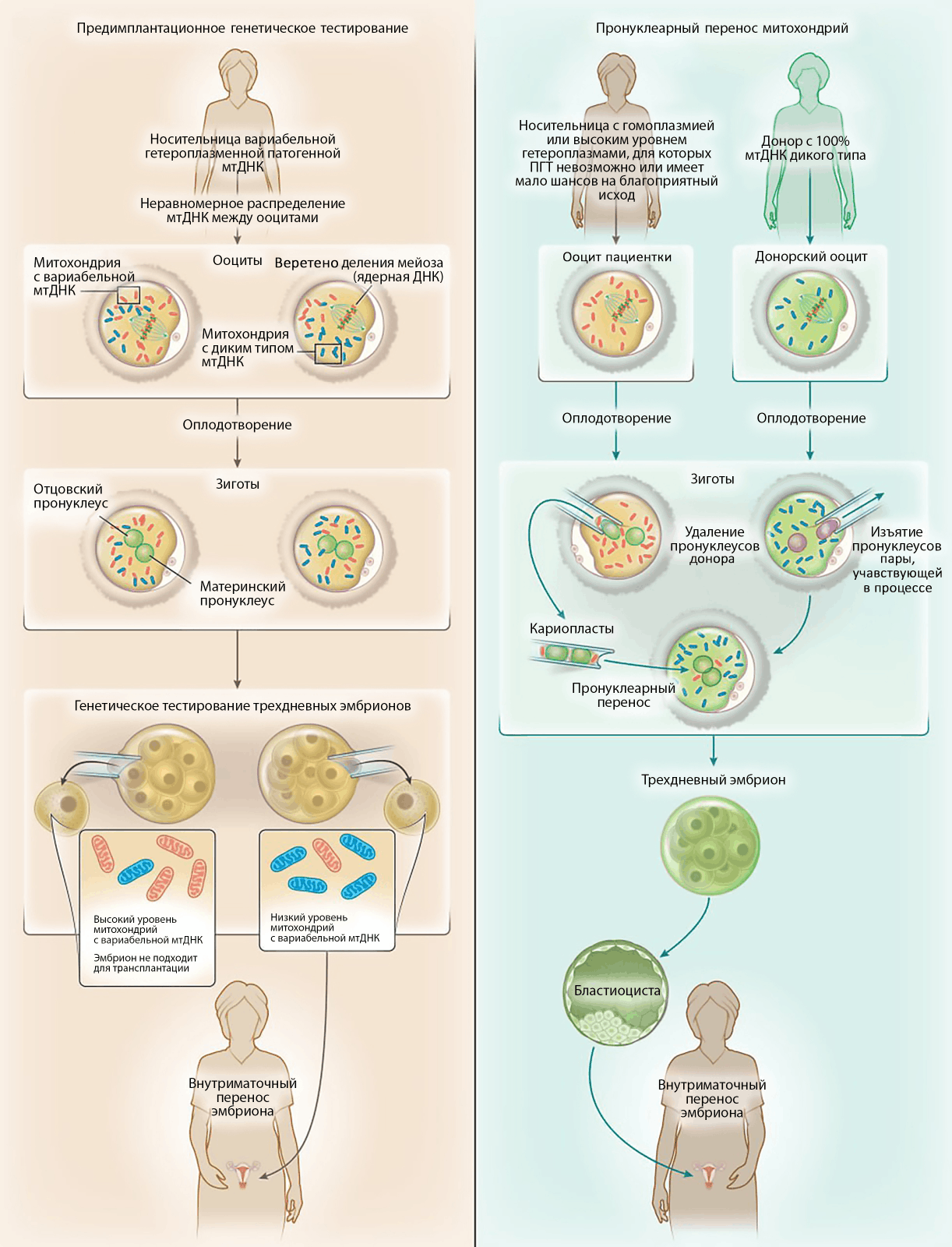 Технология пронуклеарного переноса