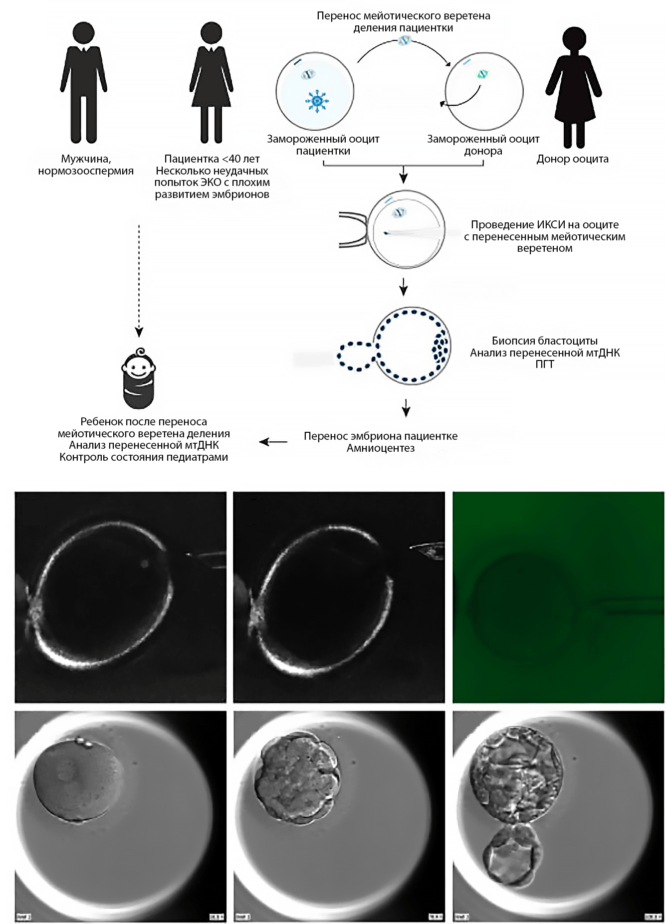 Технология переноса мейотического веретена деления