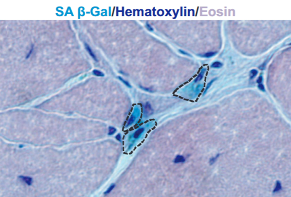 Срез мышцы с SA β-Gal клетками, выделенными пунктирной линией