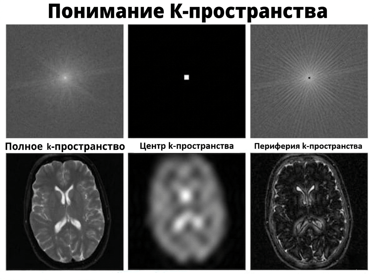 Роль k-пространства в формировании МРТ-изображения