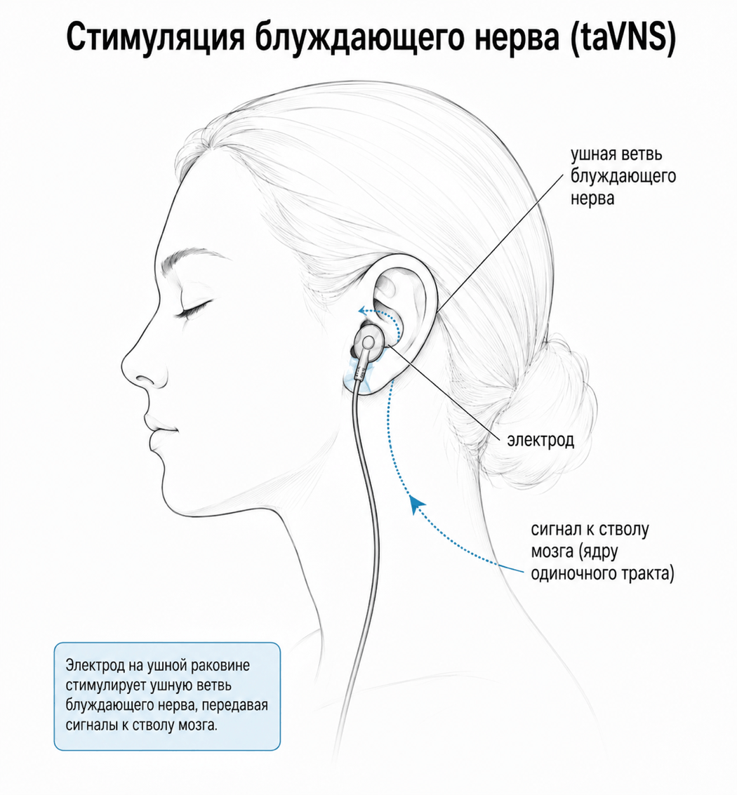 Схема устройства для стимуляции ушной ветви блуждающего нерва