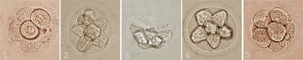Фотографии эмбрионов человека