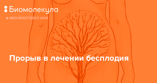 Бесплодие у женщин - причины, факторы, симптомы, признаки, диагностика, лечение