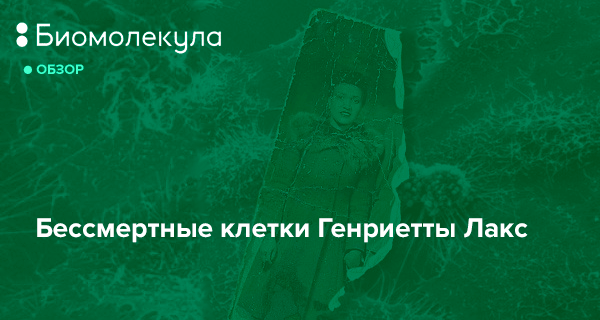 Используйте карту генриетты. Клетки Генриетты Лакс. Бессмертные клетки hela. Бессмертные клетки Генриетты Лакс презентация.