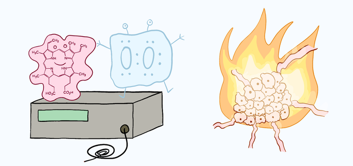 Фотодинамическая терапия: как фотосенсибилизатор и лазер спасают человеческие жизни