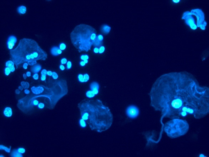 Узоры из ДНК, или красота требует жертв