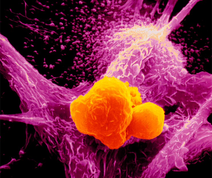 Фагоцит микрофотография. Макрофаги это клетки. Микрофаги,макрофаги,киллеры. Макрофаг в микроскопе. Макрофаги иммунитет