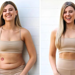 Purisaki Patches Reviews