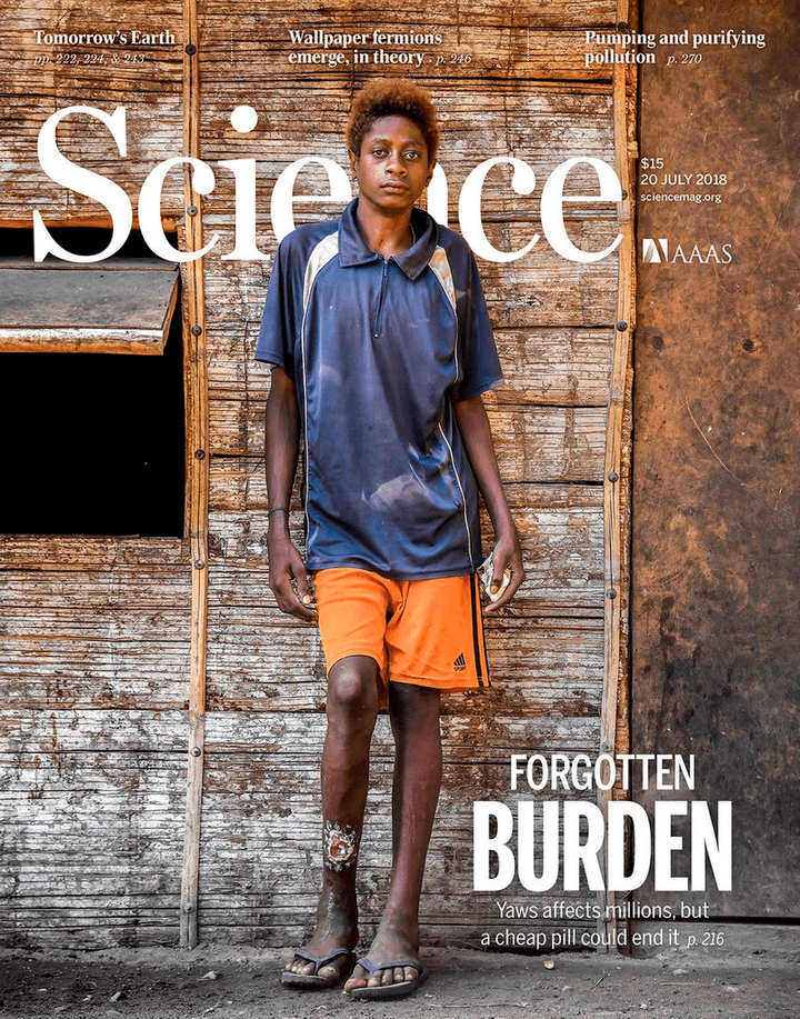 SciNat за июль 2018 #3: сила грамотрицательных бактерий,  «потерянное поколение» молодых ученых и есть или не есть мясо