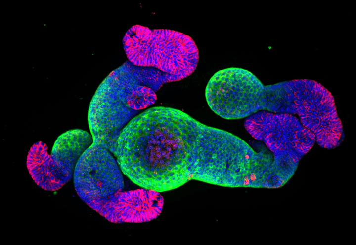 От эксперимента до индустрии: как органоиды строят мост между наукой и бизнесом