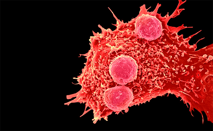 От слов к делу: технологию CRISPR-Cas впервые применили для лечения онкозаболеваний