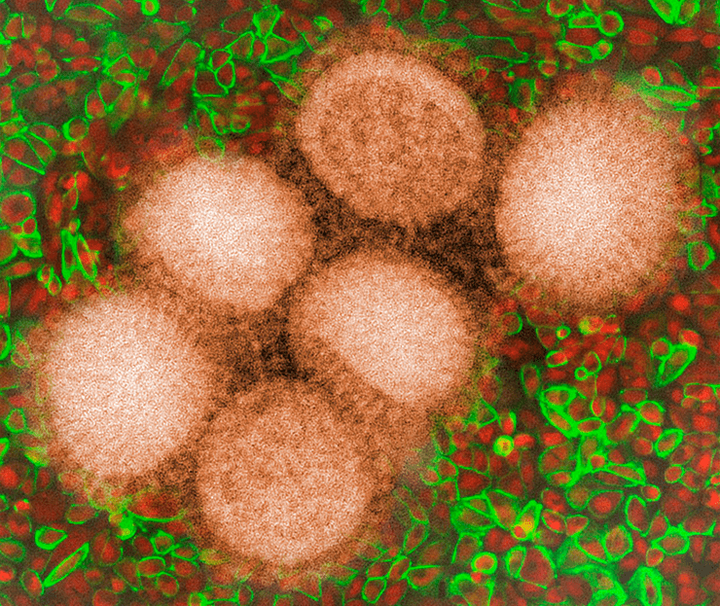 Молекулярное двурушничество: гены человека работают на вирус гриппа