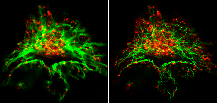 Лучше один раз увидеть, или Микроскопия сверхвысокого разрешения