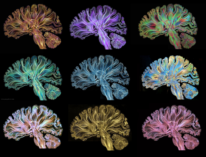 Опухоли мозга как болезни нейронных сетей
