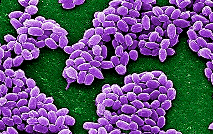 Сибирская язва как биологическое оружие