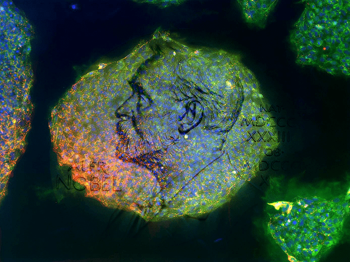 Нобелевская премия по физиологии и медицине (2012): индуцированные стволовые клетки