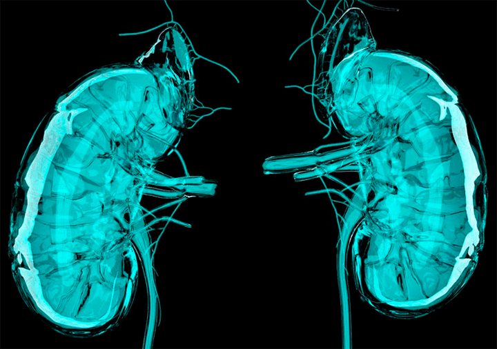Антиоксиданты против пиелонефрита