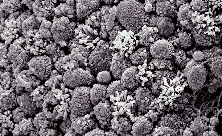 Эндометрий как альтернативный источник стволовых клеток